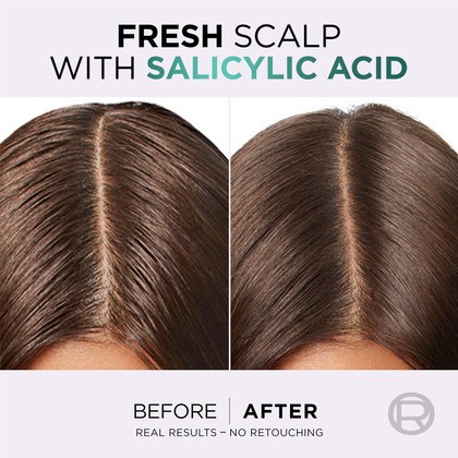 1 woman before and after using hyaluron pure conditioner with moisturized lengths