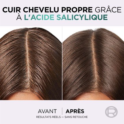 1 femme avant et après l'utilisation du revitalisant hyaluron pure avec des racines propres