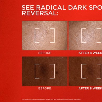 Clinical infographic titled "SEE RADICAL DARK SPOT REVERSAL:" in English, presenting two sets of "Before" and "After 8 Weeks" close-up skin comparison photographs showing dark spot reduction on lighter and darker skin tones.
