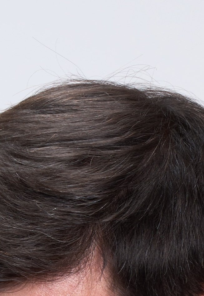 Top view of the same hair after product application. The thinning area is now filled and grey hairs are covered, giving the hair a significantly fuller and more uniform appearance.