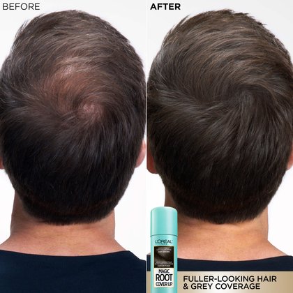 Before and after comparison of the back of a man's head. On the left, a sparse area with grey hair is visible at the crown. On the right, the product has perfectly covered the greys and made the hair look fuller. The text states 'FULLER-LOOKING HAIR & GREY COVERAGE'