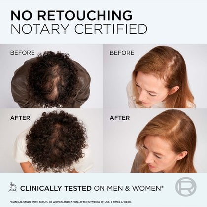A man and a woman before and after the density booster treatment. Afterwards, their hair was denser and fuller.
