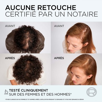Un homme et une femme avant et après la cure density booster. Après, ils ont les cheveux plus dense et plus volumineux
