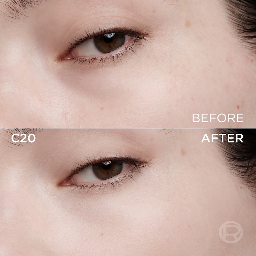 A split image comparing the area under a person's left eye. The top section, labeled 'BEFORE', shows clear skin with some small spots and minor imperfections. The bottom section, labeled 'C20' and 'AFTER', displays the same facial area with visibly smoother, more even-toned, and blemish-free skin, suggesting the effect of a cosmetic product. A subtle 'R' logo is visible in the bottom right of the 'AFTER' section