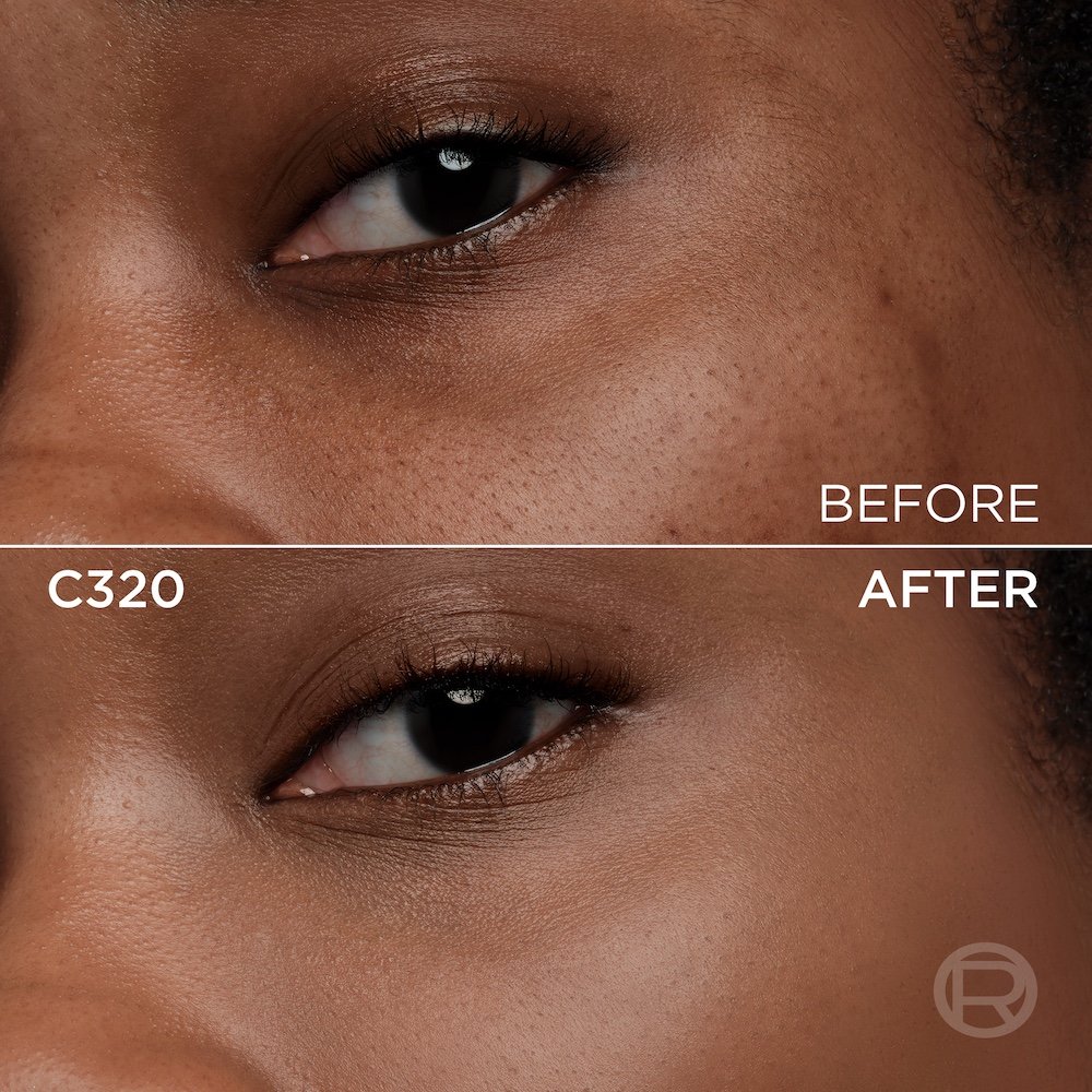 A split image showing a before and after comparison of a dark-skinned person's under-eye and cheek area. The top section, labeled 'BEFORE', displays skin with visible texture, pores, and slight unevenness in tone. The bottom section, labeled 'C320' and 'AFTER', shows the same facial area with noticeably smoother, more even-toned skin, and reduced imperfections, following the application of a cosmetic product. A subtle 'R' logo is also visible in the bottom right of the 'AFTER' portion