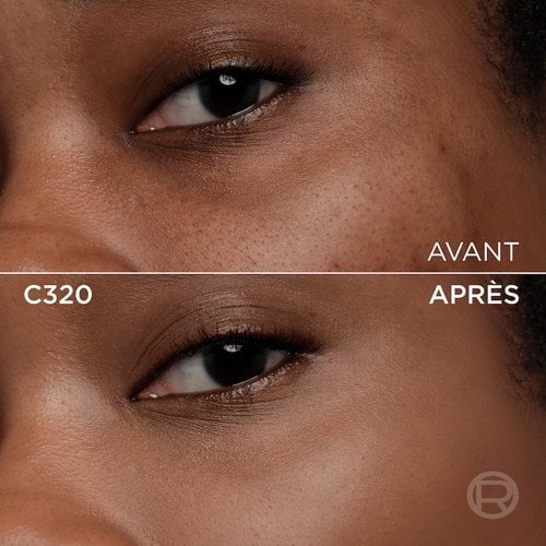 Image divisée montrant un comparatif avant et après de la zone sous l'œil et de la joue d'une personne à la peau foncée. La section supérieure, étiquetée 'BEFORE' (Avant), présente une peau avec une texture visible, des pores et une légère inégalité de teinte. La section inférieure, étiquetée 'C320' et 'AFTER' (Après), montre la même zone du visage avec une peau visiblement plus lisse, plus unifiée et des imperfections atténuées, suite à l'application d'un produit cosmétique. Un discret logo 'R' est également visible en bas à droite de la partie 'APRÈS'