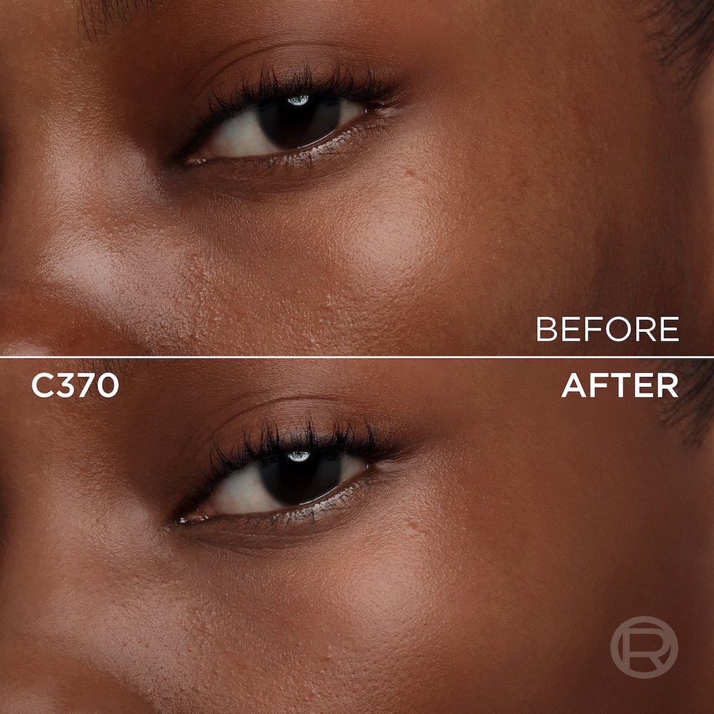 A split image showing a before and after comparison of a very dark-skinned person's under-eye and cheek area. The top section, labeled 'BEFORE', displays skin with visible texture, pores, and slight unevenness in tone under the eye. The bottom section, labeled 'C370' and 'AFTER', shows the same facial area with noticeably smoother, more even-toned skin, and reduced imperfections, following the application of a cosmetic product. A subtle 'R' logo is also visible in the bottom right of the 'AFTER' portion