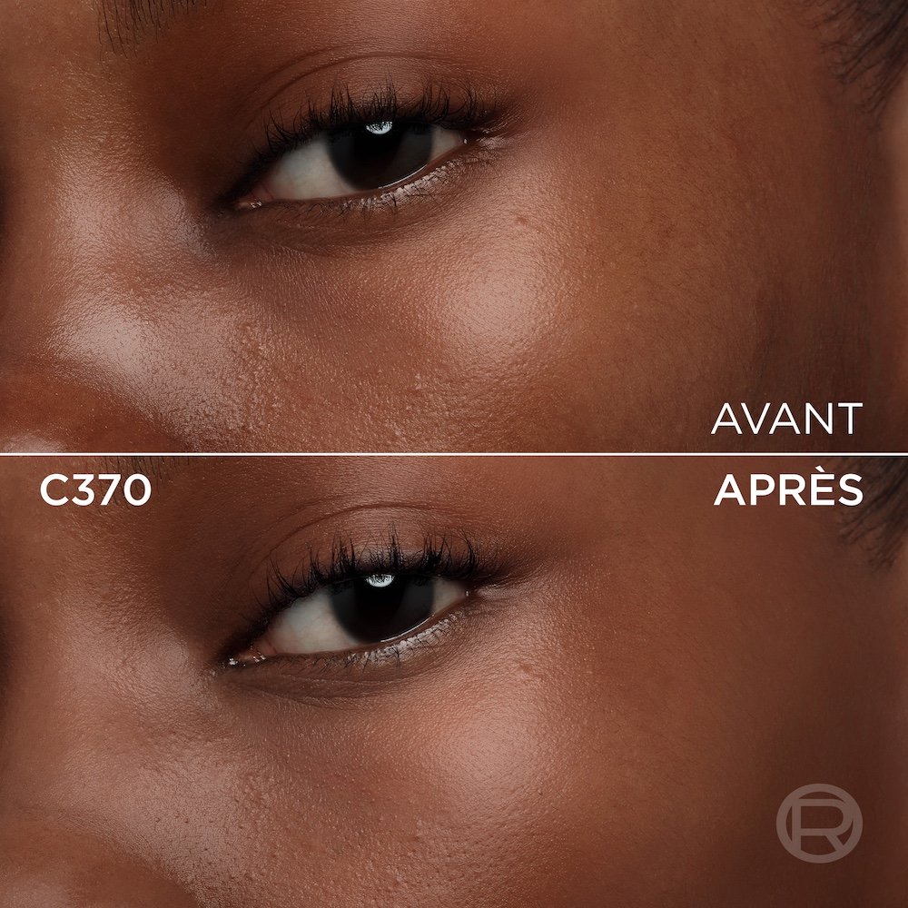 Image divisée montrant un comparatif avant et après de la zone sous l'œil et de la joue d'une personne à la peau très foncée. La section supérieure, étiquetée 'BEFORE' (Avant), présente une peau avec une texture visible, des pores et une légère inégalité de teinte sous l'œil. La section inférieure, étiquetée 'C370' et 'AFTER' (Après), montre la même zone du visage avec une peau visiblement plus lisse, plus unifiée et des imperfections atténuées, suite à l'application d'un produit cosmétique. Un discret logo 'R' est également visible en bas à droite de la partie 'APRÈS
