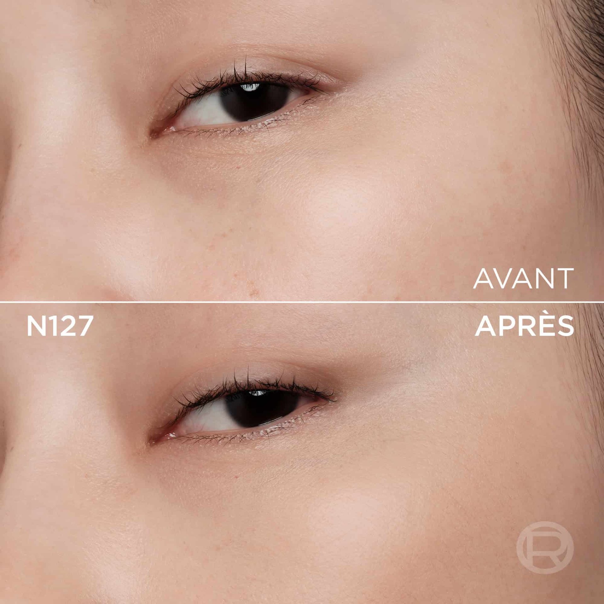 Image divisée montrant un comparatif avant et après de la zone sous l'œil et de la joue d'une personne à la peau claire. La section supérieure, étiquetée 'BEFORE' (Avant), présente une peau avec quelques petites taches de rousseur et une légère décoloration sous l'œil. La section inférieure, étiquetée 'N127' et 'AFTER' (Après), montre la même zone du visage avec une peau visiblement plus unifiée, plus lisse et des imperfections atténuées, suite à l'application d'un produit cosmétique. Un discret logo 'R' est également visible en bas à droite de la partie 'APRÈS