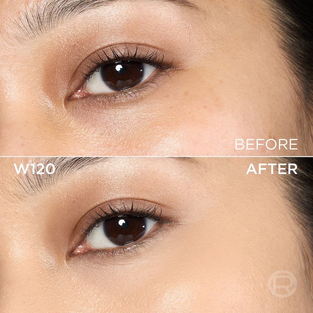 A split image showing a before and after comparison of an eye area. The top section, labeled 'BEFORE', displays skin with visible freckles and slight discoloration under the eye. The bottom section, labeled 'W120' and 'AFTER', shows the same eye area with noticeably more even-toned, smoother, and brighter skin, following the application of a cosmetic product. A subtle 'R' logo is also visible in the bottom right of the 'AFTER' portion.