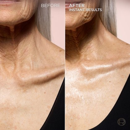 A split image shows a "BEFORE" and "AFTER" comparison of an older person's neck and décolletage. The "BEFORE" side, on the left, displays skin with visible lines and a less radiant appearance. The "AFTER" side, on the right, shows smoother, more luminous, and hydrated-looking skin, with the text "INSTANT RESULTS" indicating the product's immediate effect.