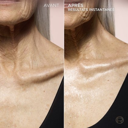Une image divisée présente une comparaison "AVANT" et "APRÈS" du cou et du décolleté d'une personne âgée. Le côté "AVANT", à gauche, montre une peau avec des rides visibles et une apparence moins radieuse. Le côté "APRÈS", à droite, présente une peau plus lisse, plus lumineuse et d'apparence hydratée, avec le texte "RÉSULTATS INSTANTANÉS" indiquant l'effet immédiat du produit.
