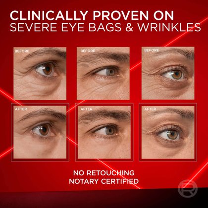 A grid of six magnified images of eyes, demonstrating the product's efficacy. Three "BEFORE" images show visible under-eye bags and wrinkles, while three "AFTER" images show a significant reduction in these concerns. Text at the top reads: "CLINICALLY PROVEN ON SEVERE EYE BAGS & WRINKLES." Text at the bottom states: "NO RETOUCHING NOTARY CERTIFIED." The images are framed with red lines on a dark red background.