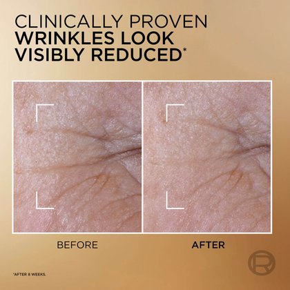 Two side-by-side magnified images of skin texture, demonstrating the product's effectiveness. The image labeled "BEFORE" shows prominent wrinkles, while the "AFTER" image shows visibly reduced wrinkles. Text states: "Clinically proven wrinkles look visibly reduced* (after 8 weeks)."