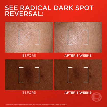 A smiling model with radiant skin holds the serum. Large text states: "97% agree skin tone appeared more even & radiant."