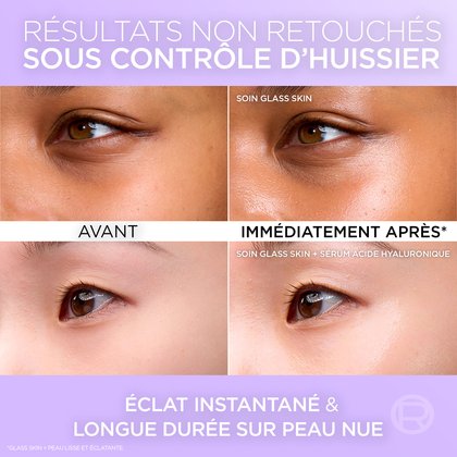 Des photos comparatives avant/après non retouchées de deux visages différents (sous contrôle d'huissier) montrant un éclat instantané et de longue durée sur peau nue immédiatement après l'application.
