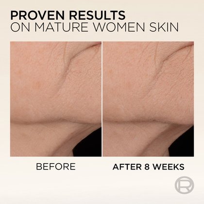 Before-and-after skin texture comparison on a mature woman's neck, showcasing smoother skin and reduced wrinkles. Text reads: "PROVEN RESULTS ON MATURE WOMEN SKIN" with labels "BEFORE" and "AFTER 4 WEEKS".