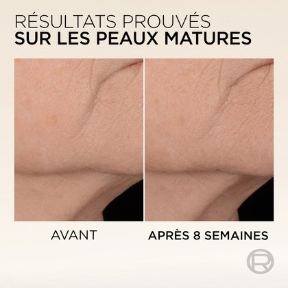 Comparaison avant-après de la texture cutanée sur le cou d'une femme mature, montrant une peau visiblement lissée et des rides réduites. Le texte indique : « RÉSULTATS PROUVÉS SUR LA PEAU DES FEMMES MATURES » avec les labels « AVANT » et « APRÈS 4 SEMAINES ».