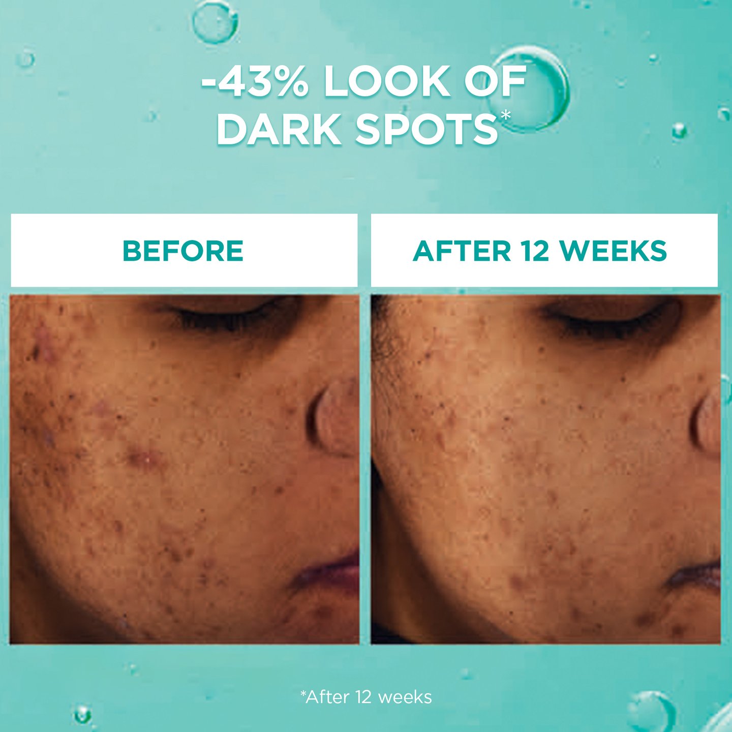 Bright Reveal 12% Niacinamide Dark Spot Serum | L'Oréal Paris