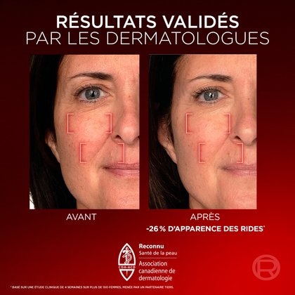 Sérum Correcteur d'Âge pour le Visage Triple Power LZR | L'Oréal Paris